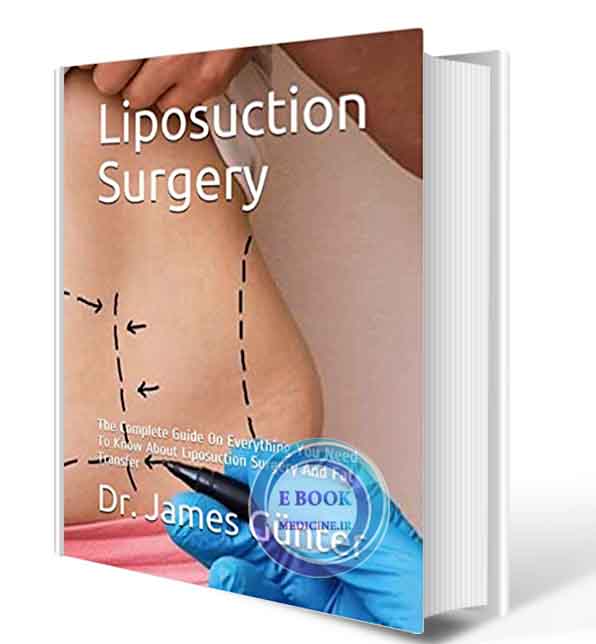 دانلود کتاب  Liposuction Surgery: The Complete Guide On Everything You Need To Know About Liposuction Surgery And Fat Transfer2020 (  PDF)